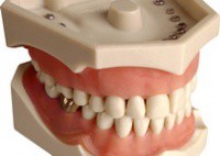 Как определить перелом челюсти?