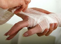 Как лечить выбитый палец: первая помощь